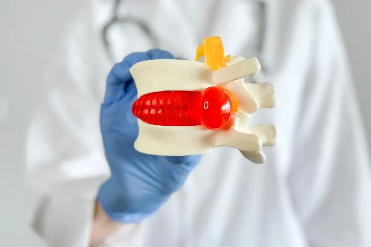 quels-sont-les-symptomes-dune-hernie-discale