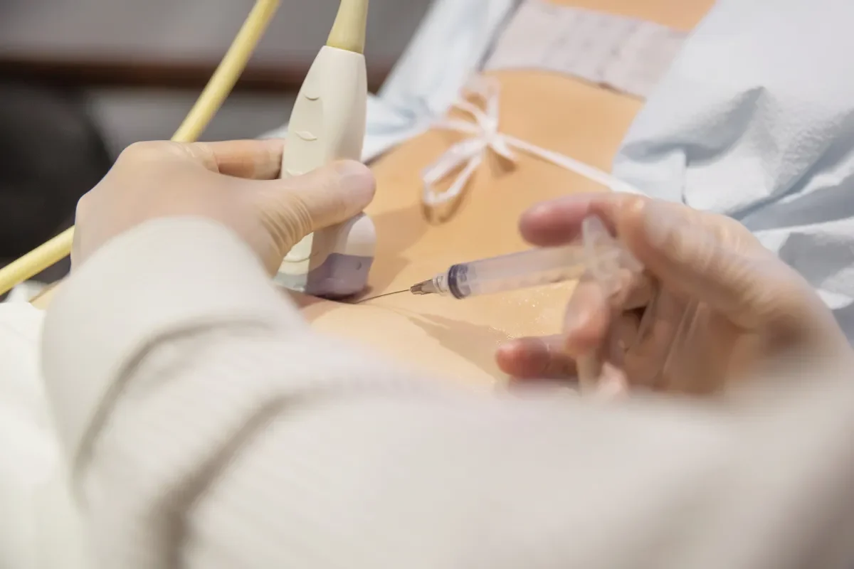 augmentation-douleur-apres-infiltration-de-cortisone-que-savoir